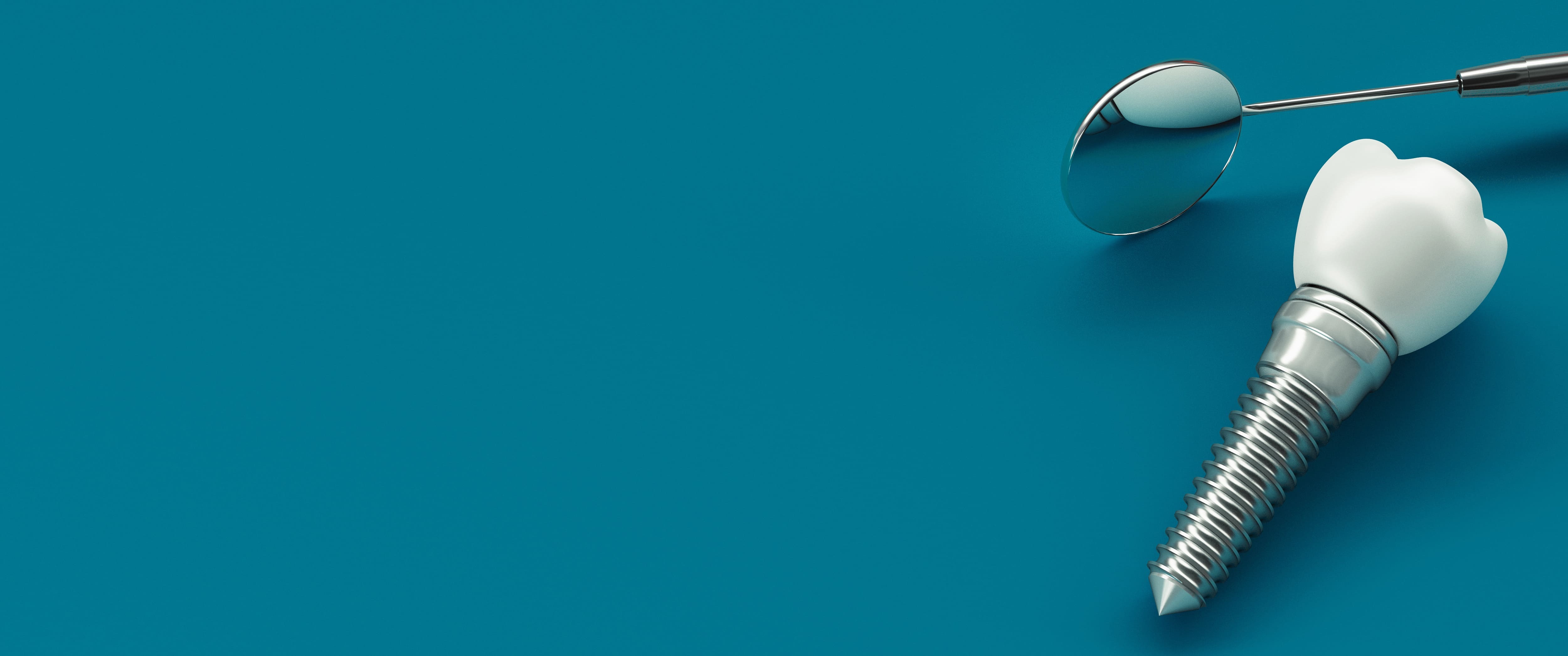 インプラントメインビジュアル画像