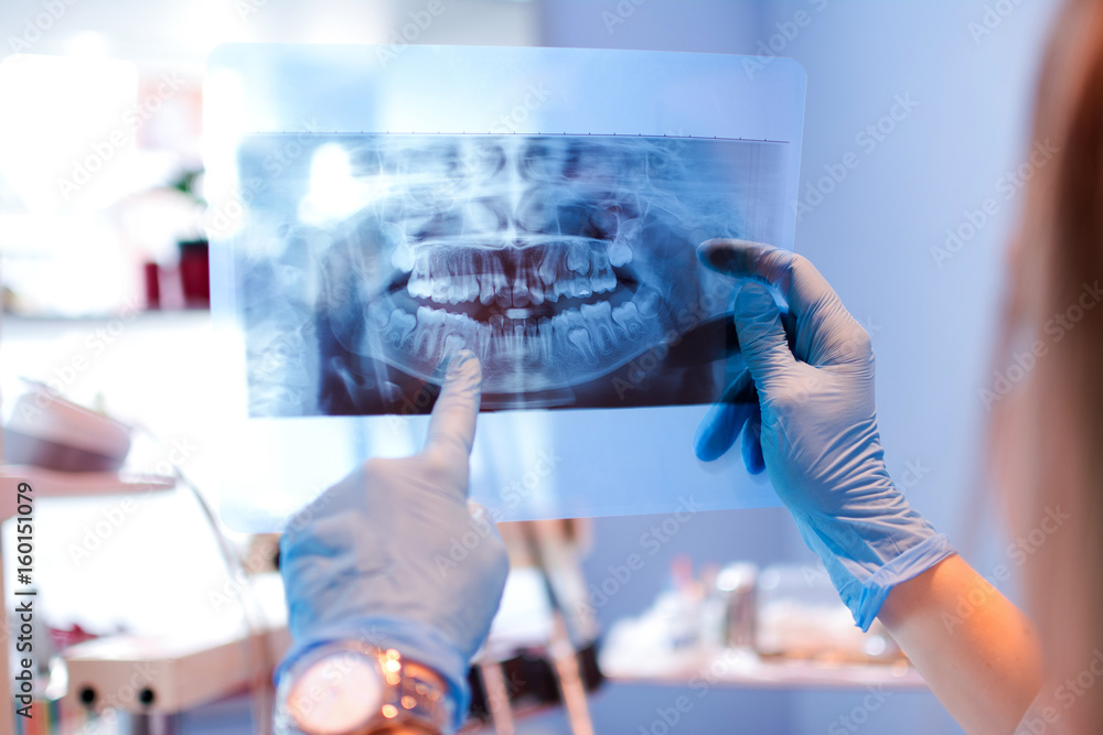 デジタルレントゲン写真